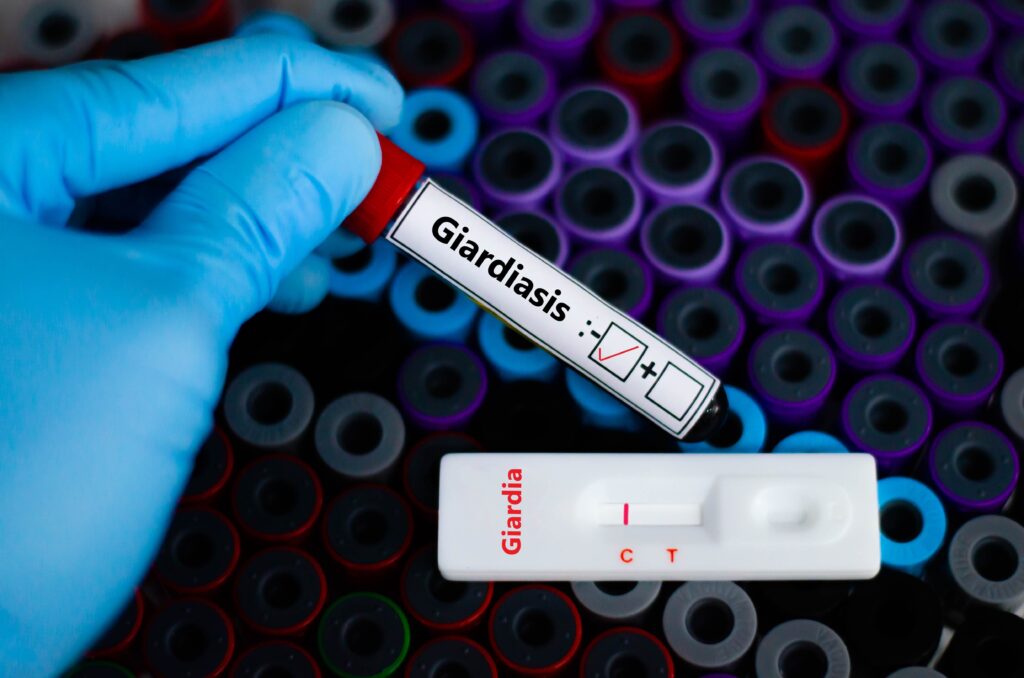 the patient negative for giardiasis by rapid diagnostic test.